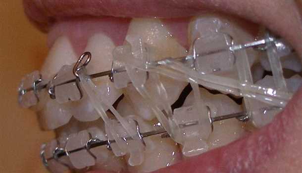 Описание процедуры и ее назначение