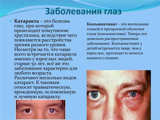 Потеря зрения: симптомы и врачебные рекоммендации