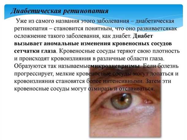 Симптомы болезней в коленных суставах. Диета при артрите коленного сустава: принципы питания, меню на неделю Болезни коленного сустава: самые частые диагнозы и способы лечения Контрактура сустава: причины, лечение, симптомы и виды