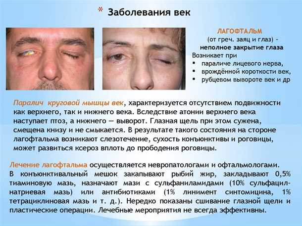 2. Усиленное испарение слезы