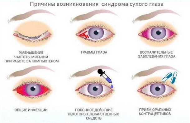 3. Регулярно делайте перерывы при нагрузке на глаза