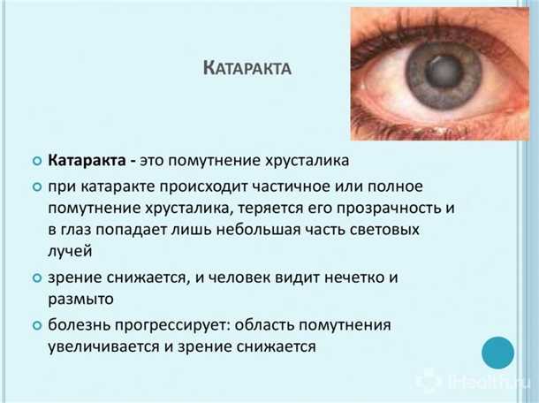 Диагностика «сухого глаза»
