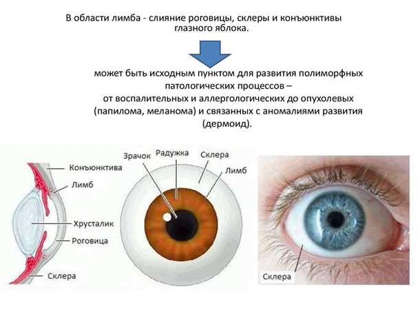 Как повысить здоровье склеры глаза