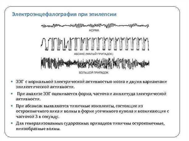 Сосудистые аномалии и их связь с развитием эпилепсии: клинические и электроэнцефалографические аспекты.