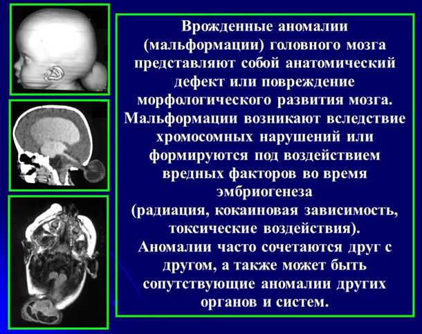 Влияние сосудистых изменений на речевую функцию