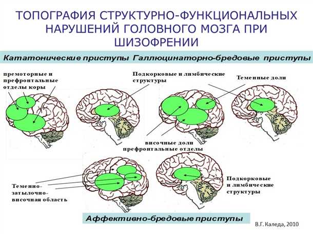 Сосудистые аномалии и нарушения сна у пациентов с шизофренией: взаимосвязь и лечение.