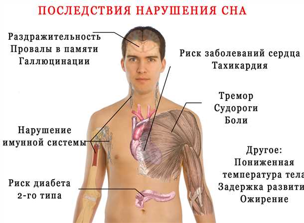 Сосудистые аномалии и расстройства сна у детей: взаимосвязь и методы коррекции.