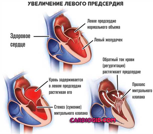 Влияние особых обстоятельств на прогноз и лечение вида патологии, связанной с необычными отклонениями в кровеносной системе
