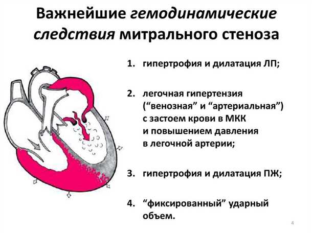 Сосудистые аномалии при синдроме пролапса митрального клапана: диагностика и ведение.