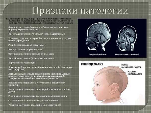 Механизмы воздействия врожденных аномалий головы и шеи на сосудистую систему