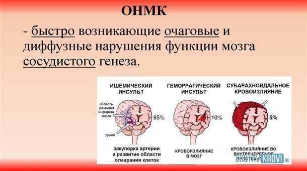 Фармакологические препараты для лечения ишемии мозга