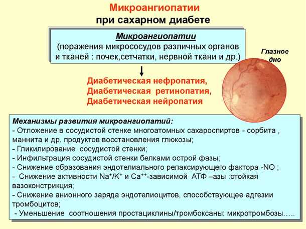 Профилактика сосудистых проблем при сахарном диабете