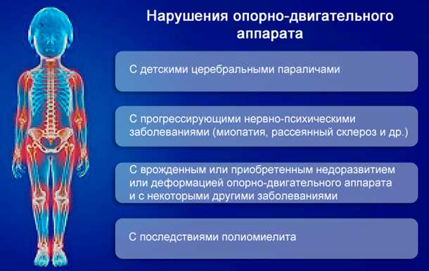 Связь варикозного расширения вен и патологий опорно-двигательного органа