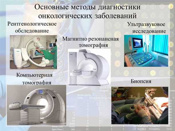 Первичная помощь при сердечно-сосудистых осложнениях у пациентов с раковыми заболеваниями