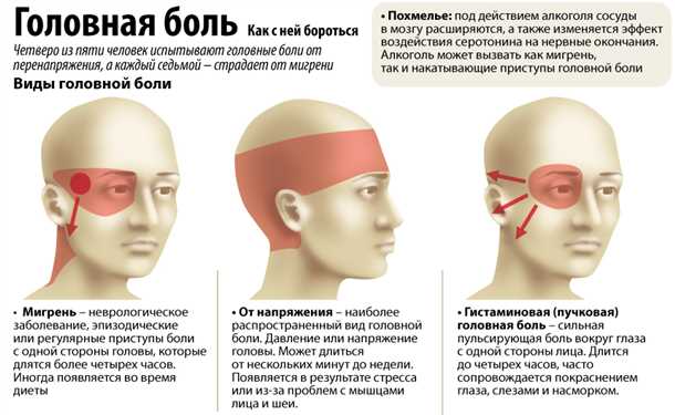 Инструментальные методы диагностики сосудистых причин головной боли