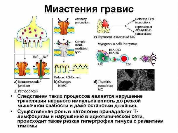 Эффективные методы улучшения состояния пациентов с миастенией гравис: роль нитратов и нитритов