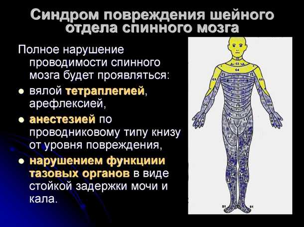 Проявления нарушений двигательной функции у пациентов