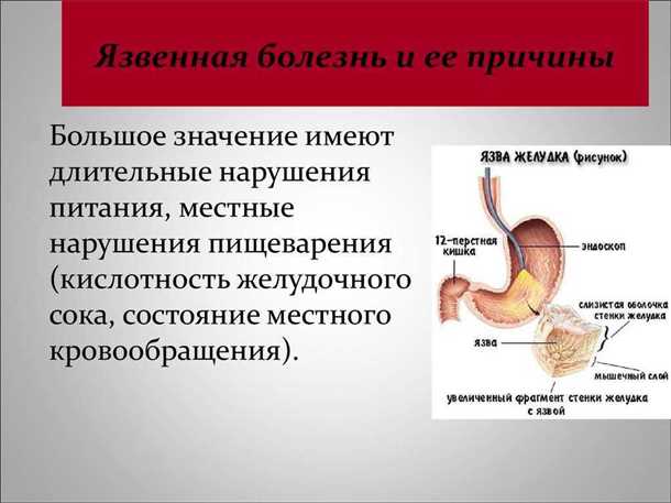 3. Вздутие живота