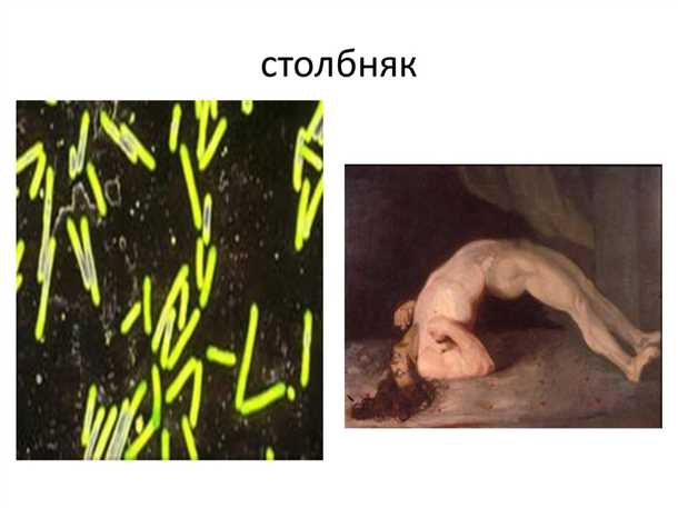 3. Хирургическое вмешательство
