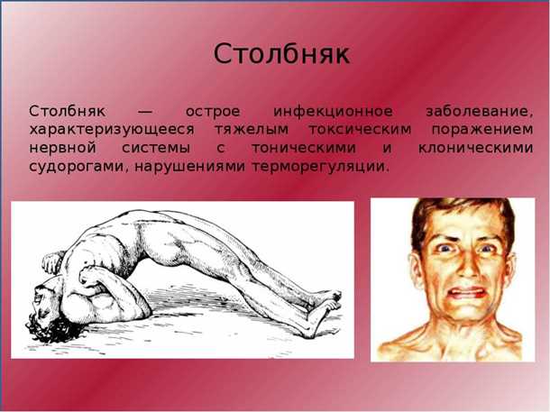 Особые профессиональные риски