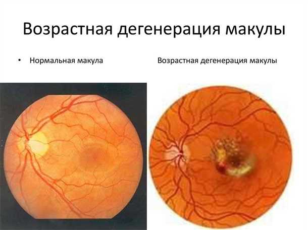 Факторы риска