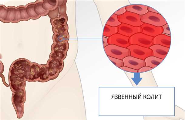 Хирургическое вмешательство