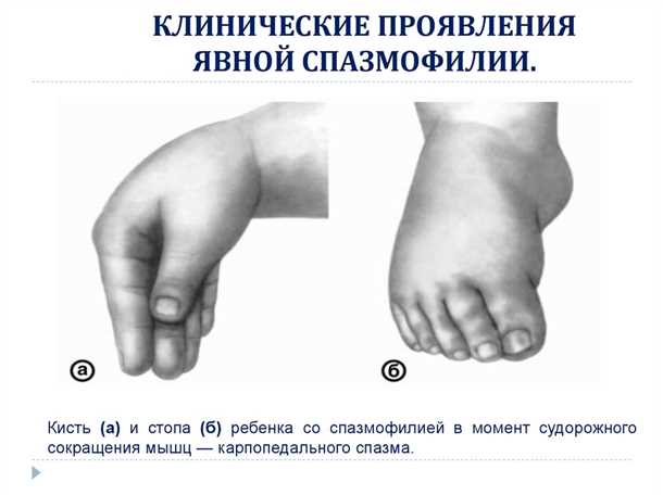 Тетания