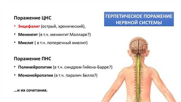 Осложнения при поражении позвоночника: последствия и возможные проблемы