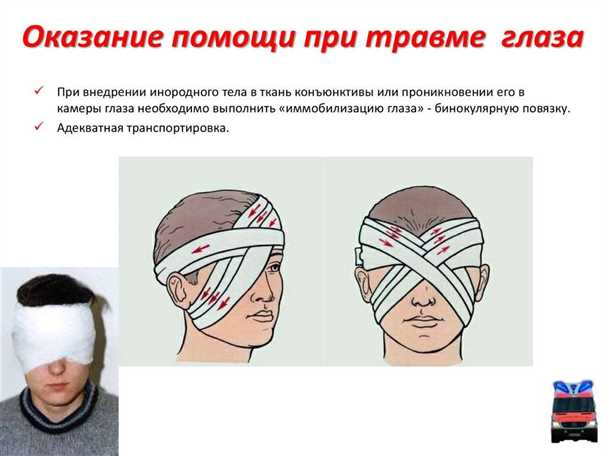 Основные причины травм глаза и как ими предотвратить