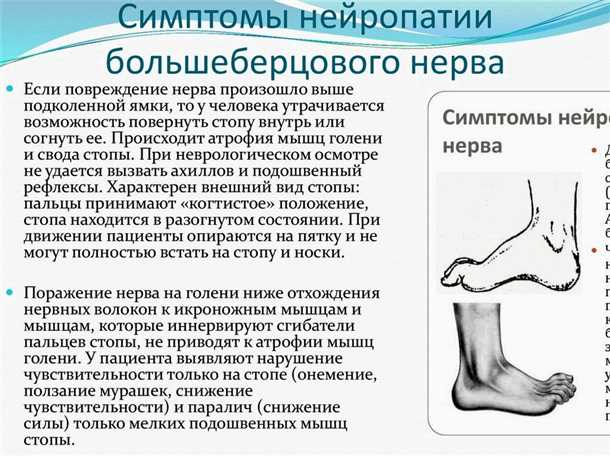 Диагностика травматических невропатий: методы и обследование
