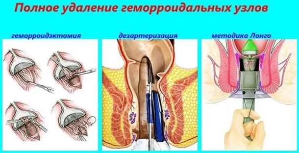 3. Герметичная одежда и неправильное питание