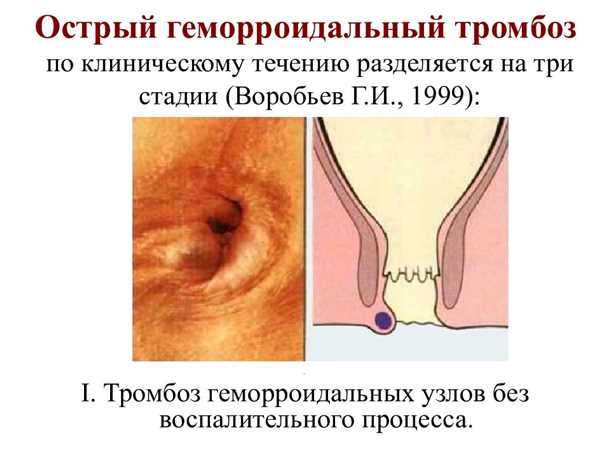 2. Сидячий образ жизни