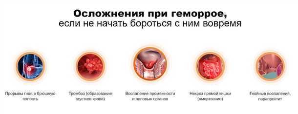 Диагностика и лечение тромбоза геморроидального узла