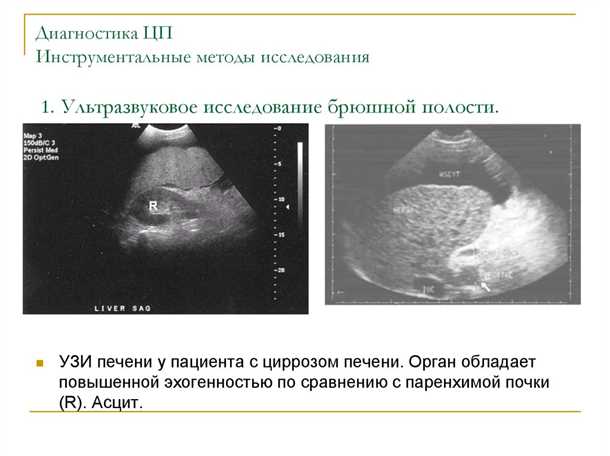 1. Нарушение структуры печени