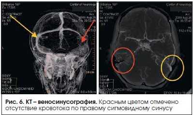 Регулярная физическая активность