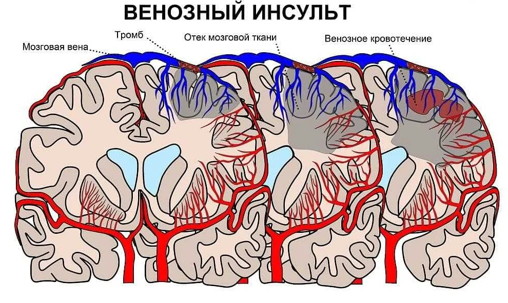 Поведенческие аспекты восстановления