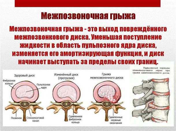 Ограничение движений