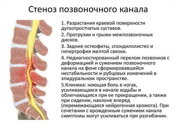 Диагностика и лечение заболеваний позвоночника