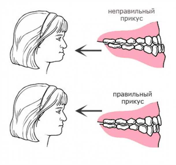 Виды прикуса