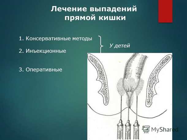 Реабилитация и послеоперационный уход
