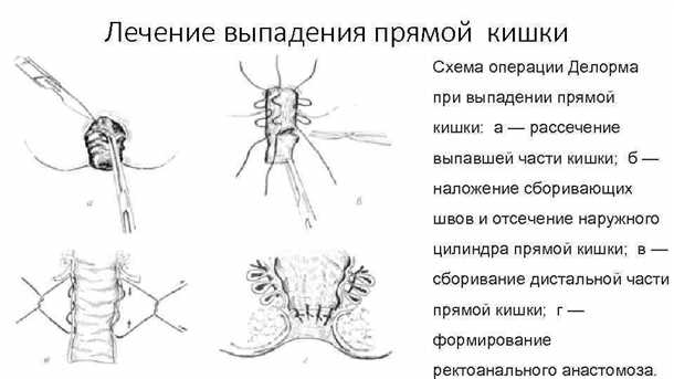 3. Ограничить физическую активность