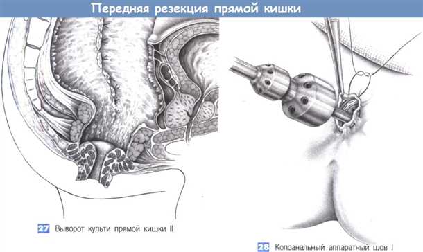 Сбалансированное питание