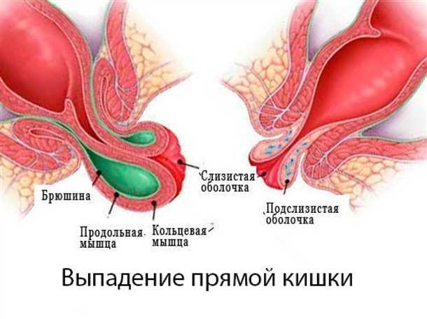 Возможные осложнения