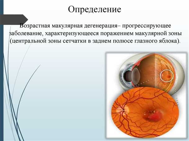 Как предотвратить развитие ВМД?