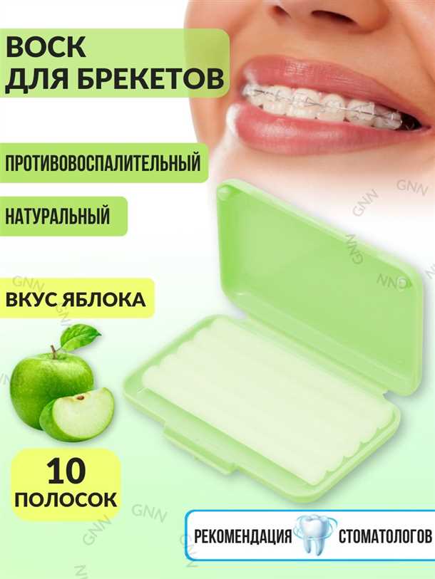 Воск для брекетов: как использовать и какой выбрать?