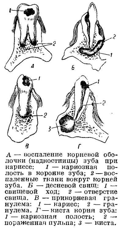 Факторы риска развития заболевания