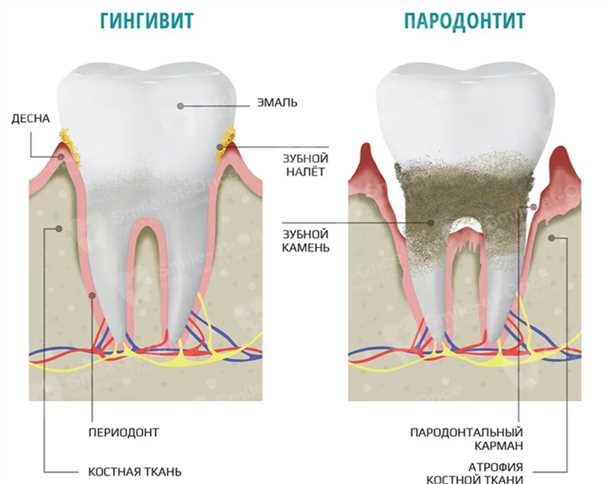 Продукты, которые следует избегать: