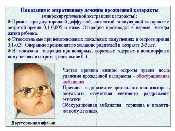 Лечение врожденной катаракты
