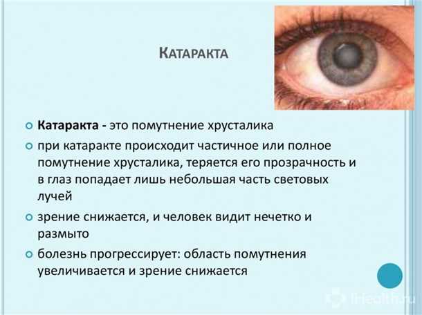 Проблемы, связанные с врожденной катарактой