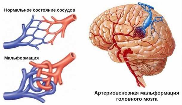 Показания для проведения ультразвуковой допплерографии